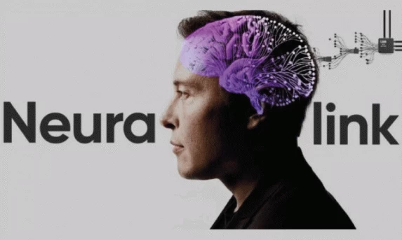 INTERNACIONAL: Empresa de Elon Musk, faz 1º implante de chip cerebral em humano.