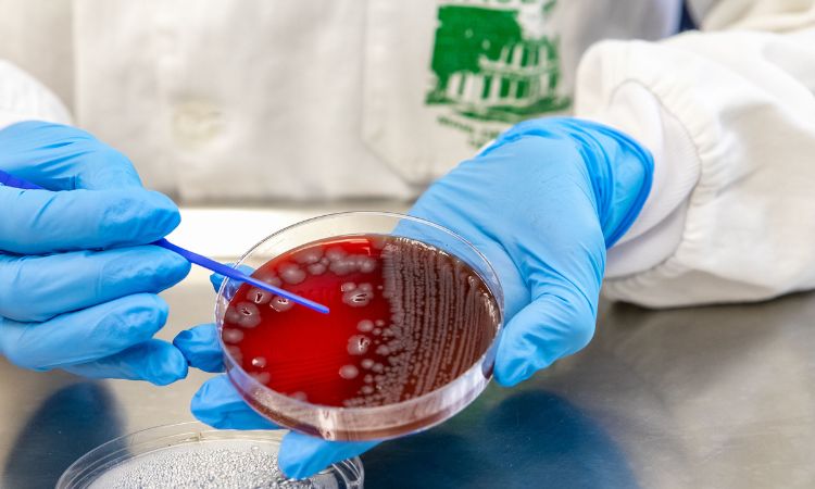 VERÃO COM SAÚDE: SESA ORIENTA POPULAÇÃO SOBRE CUIDADOS ESSENCIAIS PARA EVITAR VIROSES E SURTOS DE DIARREIA